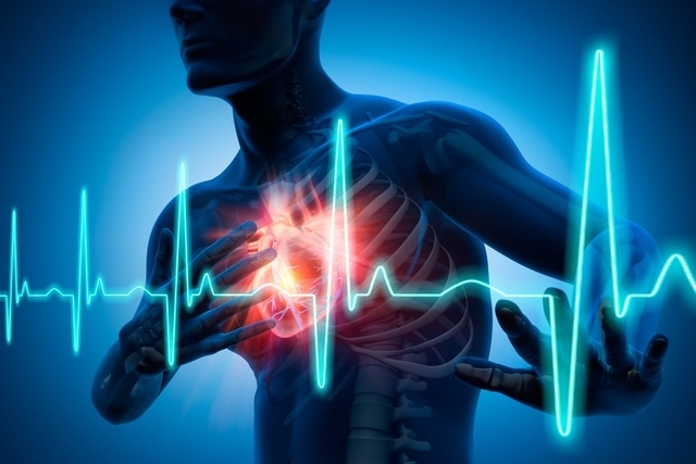 F4   Sujet en pleine crise cardiaque